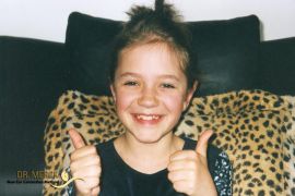 Ohren anlegen Bild nach OP 8